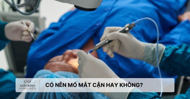 co-nen-mo-mat-can-hay-khong