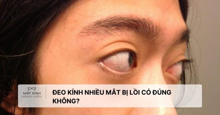 deo-kinh-nhieu-mat-bi-loi-co-dung-khong