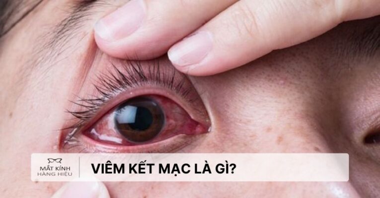 viem-ket-mac