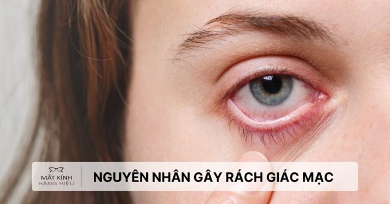 rach-giac-mac