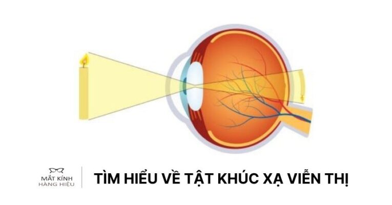 vien-thi-la-gi