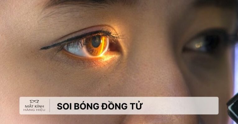 soi-bong-dong-tu