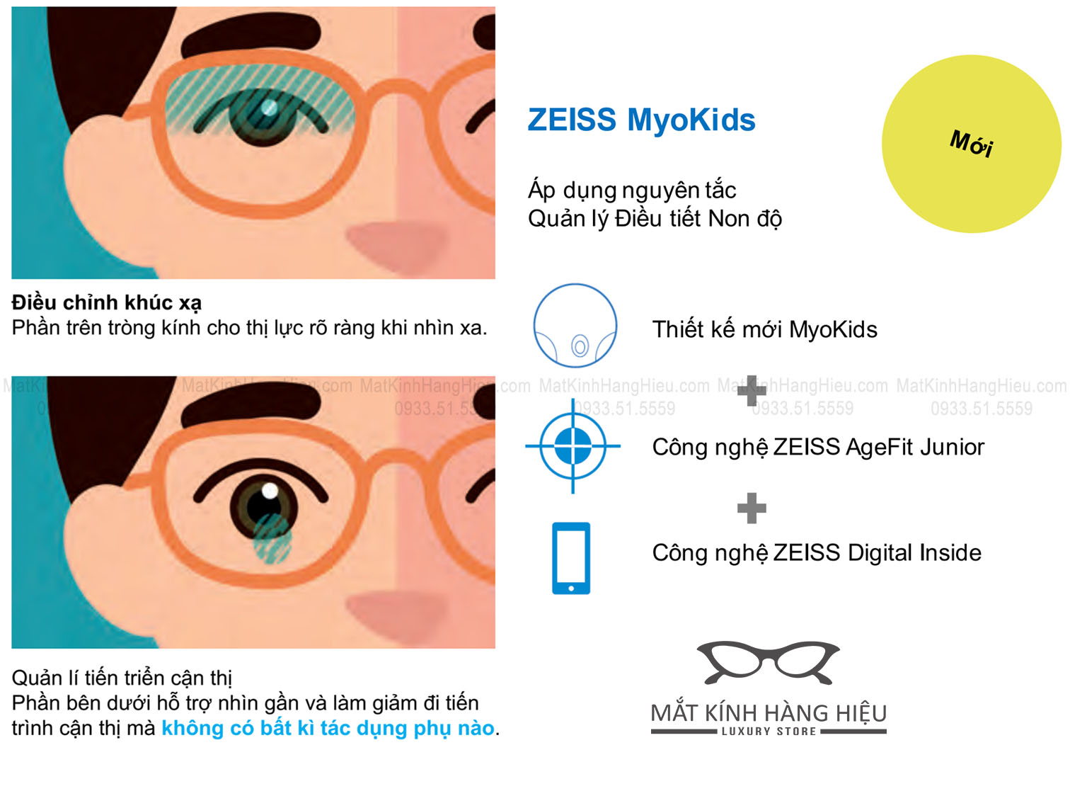 Tròng kính Zeiss MyoKids kiểm soát cận thị trẻ em