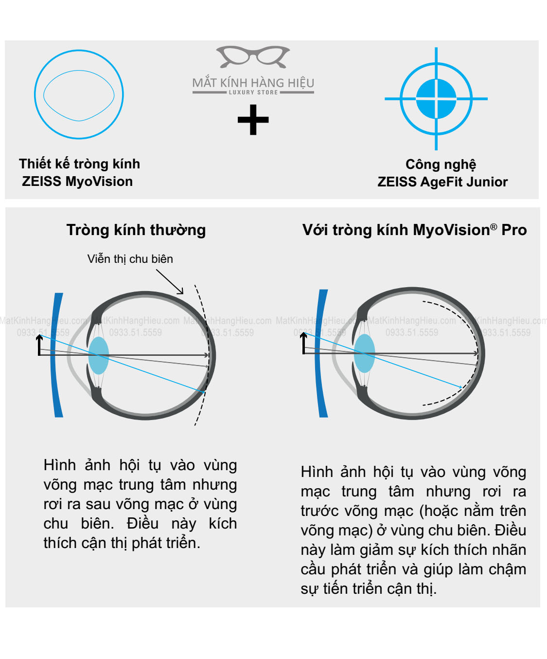 Tròng kính Zeiss MyoVision Pro kiểm soát cận thị trẻ em 1