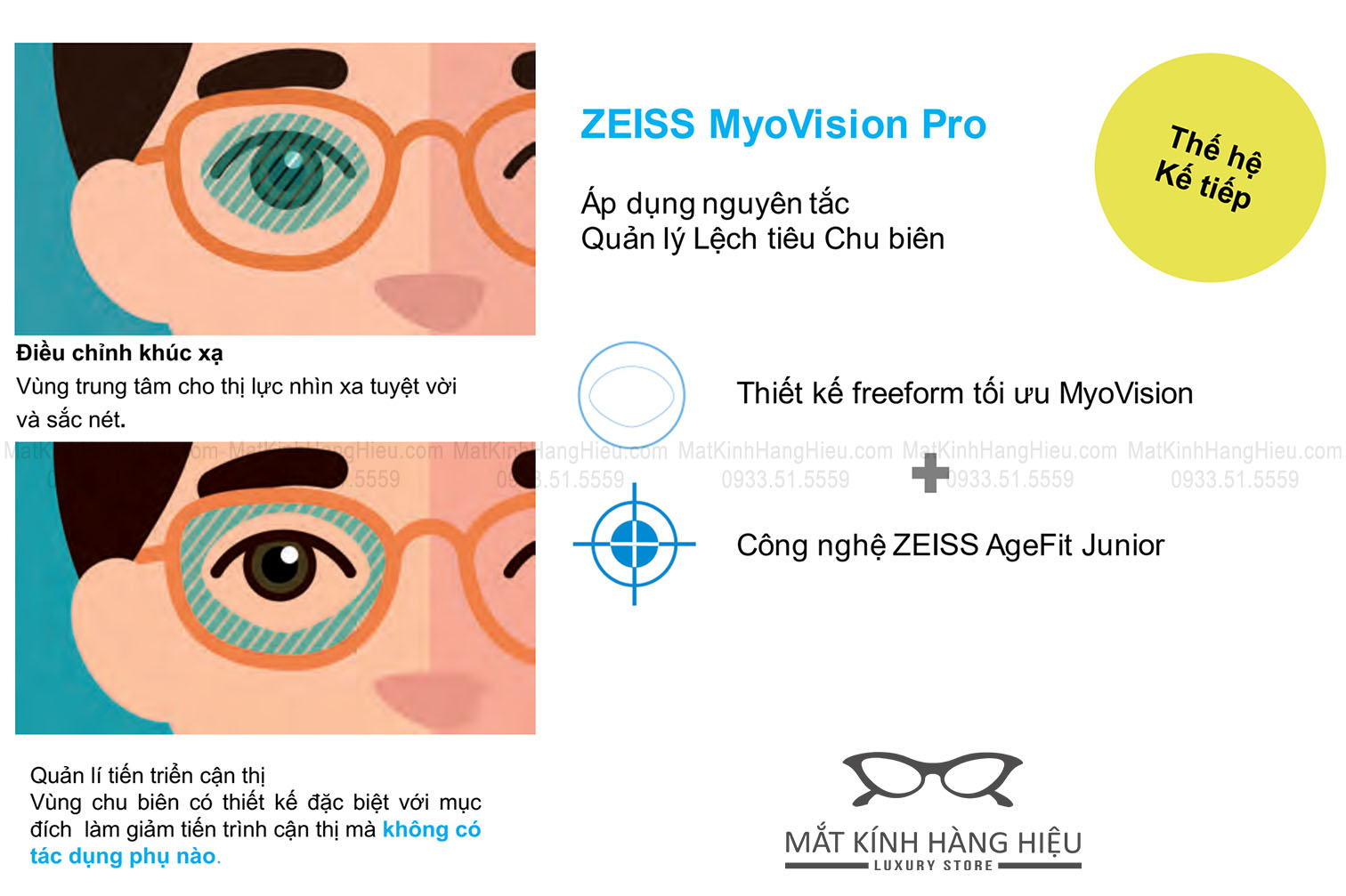 Tròng kính Zeiss MyoVision Pro kiểm soát cận thị trẻ em