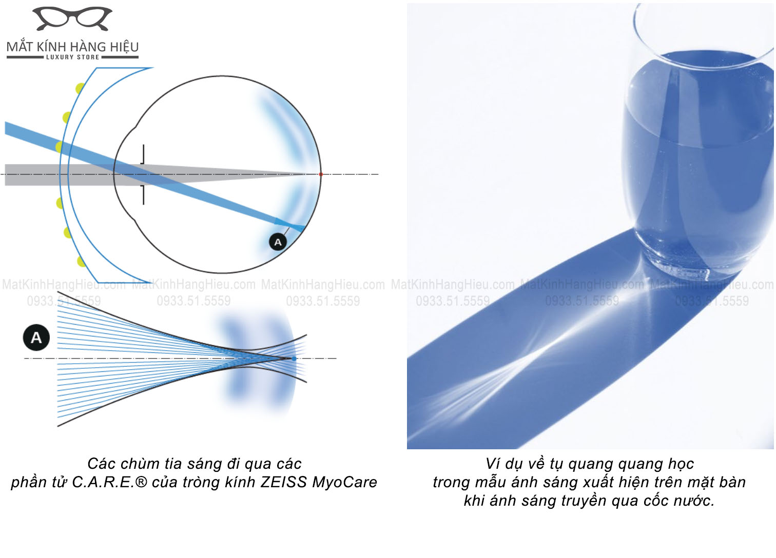 Cơ chế Care Tròng kính Zeiss MyoCare Kiểm Soát Cận Thị Trẻ Em