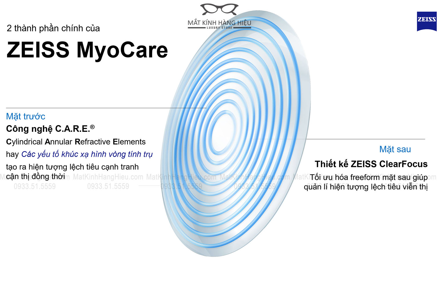 Thiết kế Tròng kính Zeiss MyoCare Kiểm Soát Cận Thị Trẻ Em