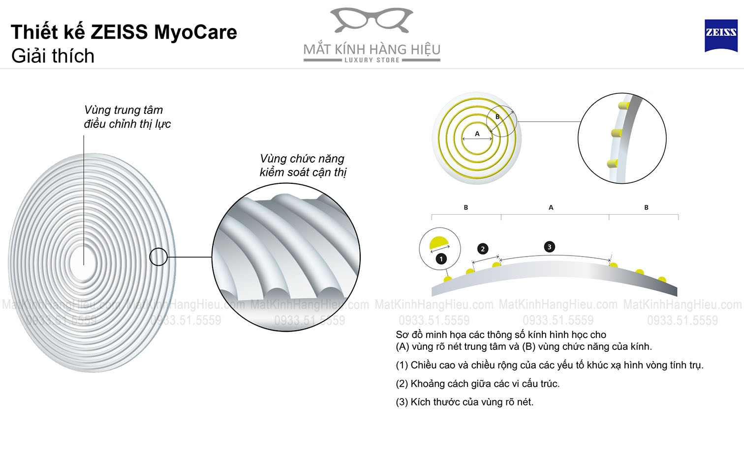 Thiết kế Tròng kính Zeiss MyoCare kiểm soát cận thị trẻ em