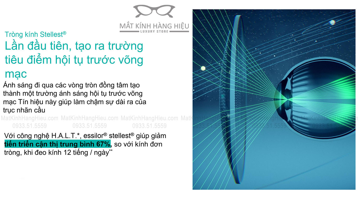 cấu tạo tròng kính essilor stellest trường tiêu điểm